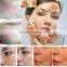 [Hot] multi-function hair removal elight shr machine Good feedback!ipl laser acne removal machine price