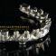 Full-arch Implant Bridge Prosthesis, Implant Denture Framework, Implant Prosthesis, Laboratoire Dentaire, Dentallabor, Laboratorio Dental, Dental Laboratory, Shenzhen LJ Dental Lab China