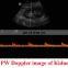 DP-20 Mindray Portable Full Digital Ultrasound Machine Price Mindray Color Ultrasound  LED
