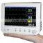 SM-500M Portable Patient Monitor(20)