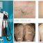 8.4 Inches Salon World Distributors Wanted Portable Diode Laser Hair Pigmented Hair Removal 1-10HZ Machine Diode Laser 808nm Hair Removal IPL Laser Machine