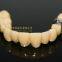Dental crown composite, dental teeth, dental prosthesis, laboratoire dentaire, Dentallabor, laboratorio dental, dental laboratory, Shenzhen LJ dental lab China
