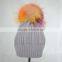 Myfur Light Grey Women Knit Hat with Real Fur Pom Pom Top