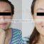 professional beauty equipment dermabrasion peeling face cleaning machine