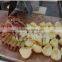 FXP-22 apple peeling and coring machine