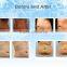 Slimming Reshaping 2016 Hot Selling Cryolipolysis Fat Freeze Slimming Machine For Weight Loss Salon Reduce Cellulite