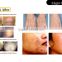Painless Eye Line Removal 3300w IPL 3 In 1 Multi-functional Beauty Equipment POPIPL CHINA Hair Removal EquipE Light/IPL/OPT/ SHR/ SSR + RF + Nd Yag Laser Skin Tightening Whitening Skin
