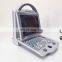 HC-A012A Hot Sale Full digital portable Doppler Color Ultrasound scanner