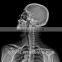 blue dry X Ray medical Film/cheap films the most popular film