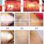 Distributors wanted 808nm diode laser in motion hair removal device