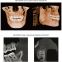 Dental 3D CBCT, Dental panoramic CBCT 3D