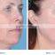Skin tightening hifu for wrinkle removal system / skin tightening machine