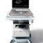 Sonostar 3D Built-in Battery Portable Vascular Cheapest Ultrasound Machine