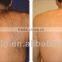Best Portable shr IPL hair removal beauty machine by Apolo