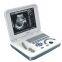 Notebook Type Black and White Ultrasound Scanner