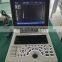 portable notebook LED digital black and white ultrasound scanner for hospital