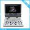 BEIJING KONTED 2016 New 3D 4D color doppler ultrasound Machine for pregnancy