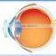 WEB Hard contact lens,Vision Correction,Low Myopia,Remove glasses from China
