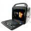 Premium 4D Color Doppler Ultrasound Scanner