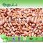 Healthy foods canned light speckled kidney beans to saudi arabia market