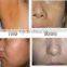 Distributor wanted ipl she laser beauty machine price / shr ipl E-light beauty salon equipment in dubai