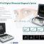 12 inch HD LCD monitor full digital  Portable medical ultrasound instruments color doppler ultrasound