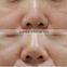 Professional PDT LED Light Facial Skin Rejuvenation Beauty Machine For Skin Rejuvenation Red Light Therapy For Wrinkles