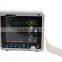 Cheap Vet Multiparameter blood pressure Veterinary Patient Monitor