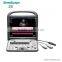 Portable ultrasonic diagnostic color doppler ultrasound equipment