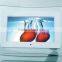 10" Inch Digital Photo Frame