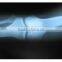 Medical dry imaging film from manufacturer,computer accessories,image sex