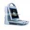 China Wholesale Supplier Full digital B mode ultrasound scanner With Certificate