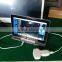 Sonostar Laptop PC based high quality medical cheapest portable ultrasound machine for sale UBook-8