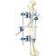 Guaranteed Quality Tibia & Percone External Fixator for Orthopedic External Fixation Surgical Instruments
