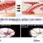 CO2 Fractional Laser Scar Removal Equipment/fractional 100um-2000um C02 Laser Equipment Stretch Mark Removal