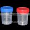 Urine and Stool Container with Screw Cap