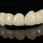 High Hardness Zirconia Dental Crown Translucent Natural Color