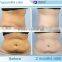 Body Reshape 2015 Cryo Lipo Shaping Zeltiq Criolipolisis Equipment Cryolipolysis Machine Handpieces