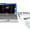 latest design USB ultrasound box scanner machine