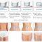 360 degree cryotherapy machine Belly weight loss body slimming device beauty personal care