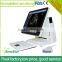 Sonostar Portable Ultrasound Color Doppler Low Prices Of Ultrasound Machine