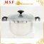 nonstick marble coating stainless steel casserole new design bakelite handles and knobs