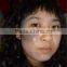 CE Certification Q Switch ND YAG Laser Naevus Of Ito Removal Machine For Tattoo Pigmentation Removal Freckles Removal