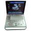 Sonostar 2016 Portable Digital Ultrasound Price Ultrasound Machine for Pregnancy C5