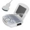 portable ultrasound scanner with 96 elements probes