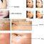  China Fractional RF Micro needle/best cream removal wrinkle/Rf needle wrinkle removal machine