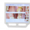 Endoscope buccal haute définition