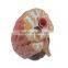 Organs Human Body Anatomy Brain Model Of Stroke