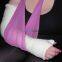 Medical Fiberglass Casting Tape Polymer Bandage Supplier Cast Bandage