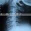 digital film medical, thermal x-ray film, film xray